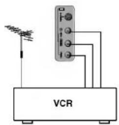 VCR