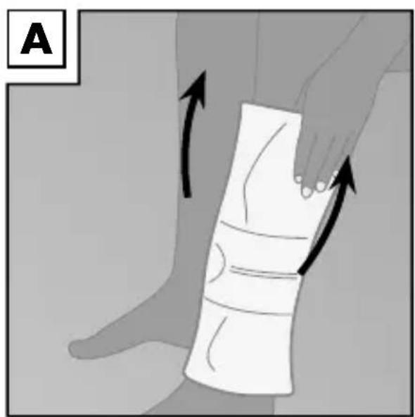 Sensiplast IAN 274651 - Anlegen der Bandage - 1
