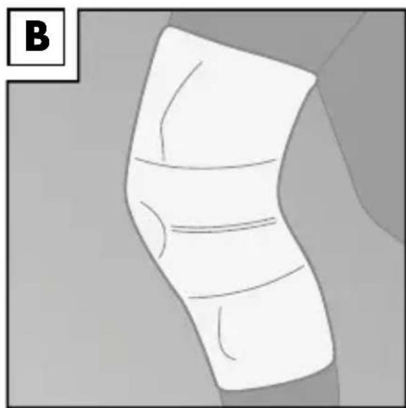 Sensiplast IAN 274651 - Applying the brace - 2