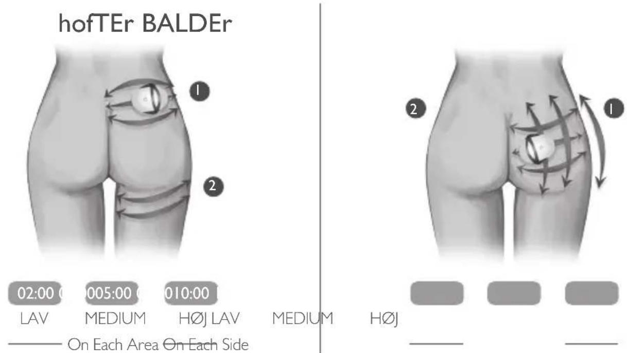 Silk'n Silhouette - Behandlingen - 1