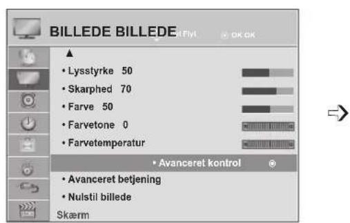 LG M2762DP - TEKNOLOGI TIL BILLEDFORBEDRING - 1