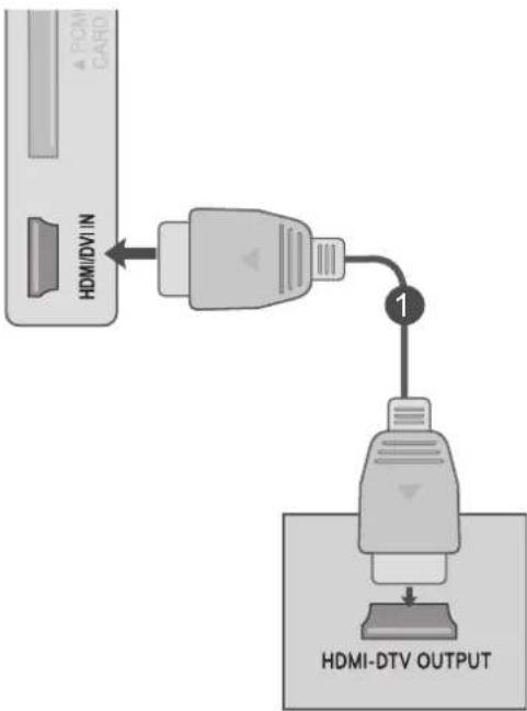 LG M2762DP - Tilslutning af en set-top boks med et HDMI-kabel - 1
