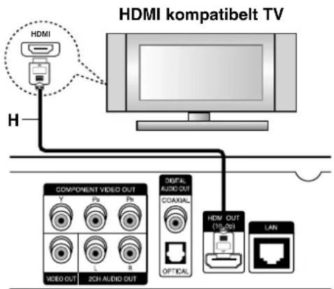 LG BD300 - Forsigtig - 1