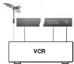 VCR