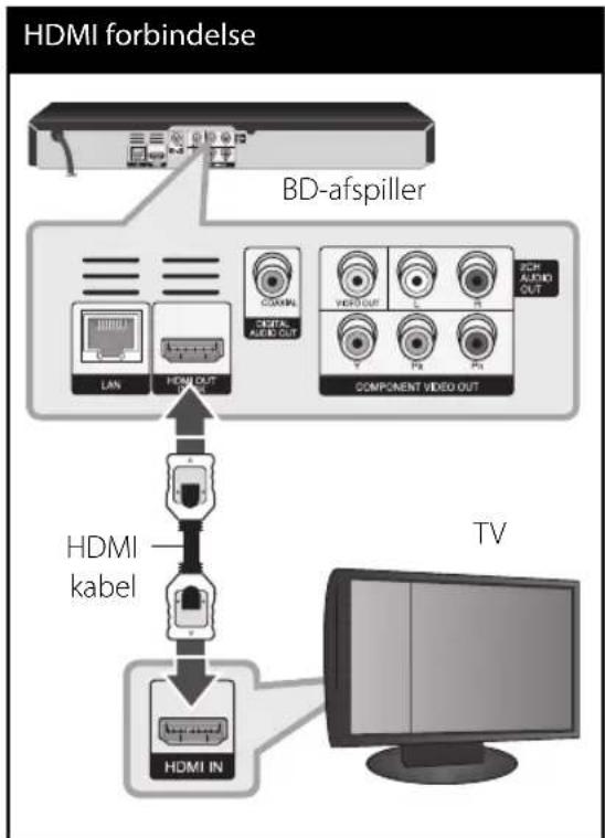LG BD560 - HDMI forbindelse - 1