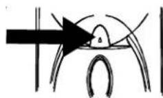 Diagram illustrating a procedure with crown and mouthpiece, showing two circular insets labeled with icons.