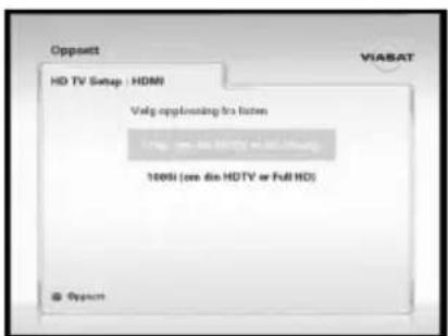 SAMSUNG ViasatHD DSB-H670N - HDMI - 1
