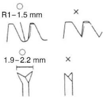 R1-1.5 mm 1.9-2.2 mm