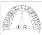 HOMEDICS TO-R101 - USO ORAL - 1