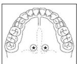 HOMEDICS TO-R101 - ORAL USE - 1