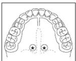HOMEDICS TO-F101 - USO ORAL - 1