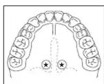 HOMEDICS TO-F101 - ORAL USE - 1