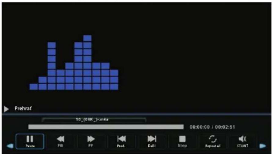 ECG 24 H04T2S2 - Ponuka Hudba - 3