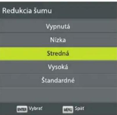 ECG 24 H04T2S2 - Redukcia šumu - 1