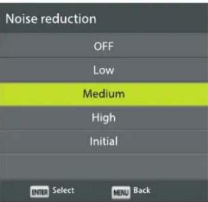 ECG 24 H04T2S2 - Noise reduction - 1