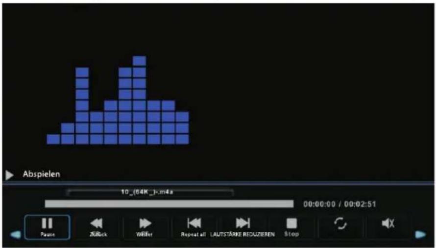 ECG 24 H04T2S2 - Menü Musik - 3