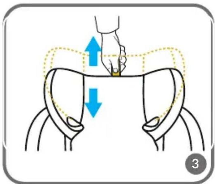 Diagram illustrating hand placement on pelvic anatomy with blue arrows indicating movement or force direction