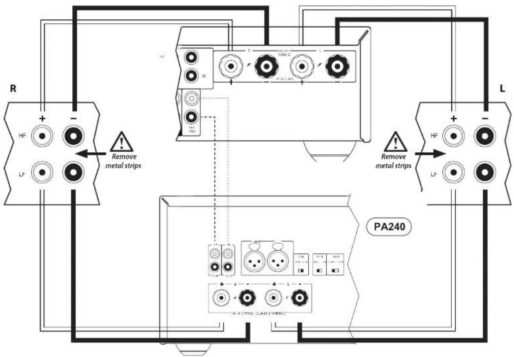 R + - HF LF Remove metal strips PA240 L + - HF LF Remove metal strips PA240