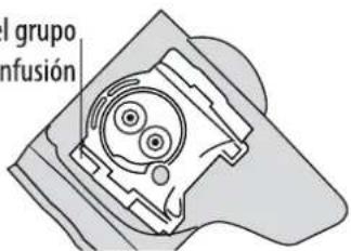 I grupo nfusión
