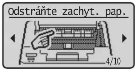 Odstráňte zachyt. pap. 4/10