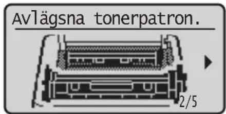 Avlägsna tonerpatron. 2/5