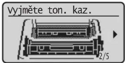 Vyjměte ton. kaz. 2/5