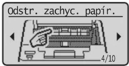 Odstr. zachyc. papír. 4/10