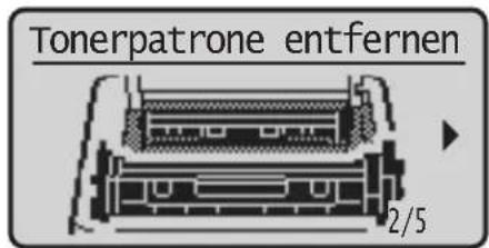 Tonerpatrone entfernen 2/5