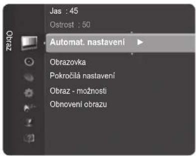 Jas : 45 Ostrost : 50 Automat. nastavení Obrazovka Pokročilá nastavení Obraz - možnosti Obnovení obrazu