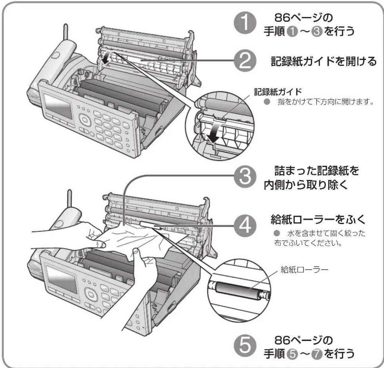 ① 86ページの 手順①~③を行う ② 記録紙ガイドを開ける 記録紙ガイド ● 指をかけて下方向に開けます。 ③ 詰まった記録紙を 内側から取り除く ④ 給紙ローラーをふく ● 水を含ませて固く絞った 布でふいてください。 給紙ローラー ⑤ 86ページの 手順⑤~⑦を行う