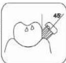 Concept Perfect Smile ZK4010 - Modes de nettoyage - 2