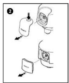 Diagram illustrating a medical procedure with labeled steps and directional arrows indicating movement or procedure.
