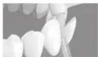 PANASONIC EW1513 - Para dentes tortos - 1