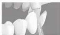 PANASONIC EW1513 - Lightly place the brush tip on the teeth and wiggle the brush. - 1