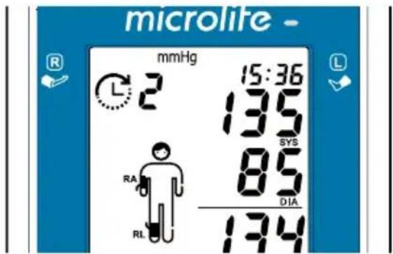 MICROLIFE WatchBP Office - Måling samtidigt på én arm og én ankel (til samtidig måling af ankel-arm) - 2