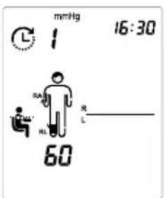 MICROLIFE WatchBP Office - Måling samtidigt på én arm og én ankel (til samtidig måling af ankel-arm) - 4