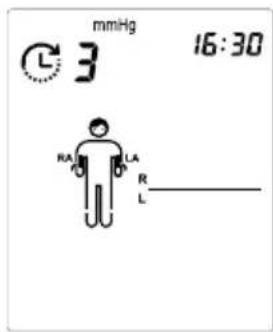 MICROLIFE WatchBP Office - Del A) Til måling af den ene arm eller begge arme samtidigt - 1