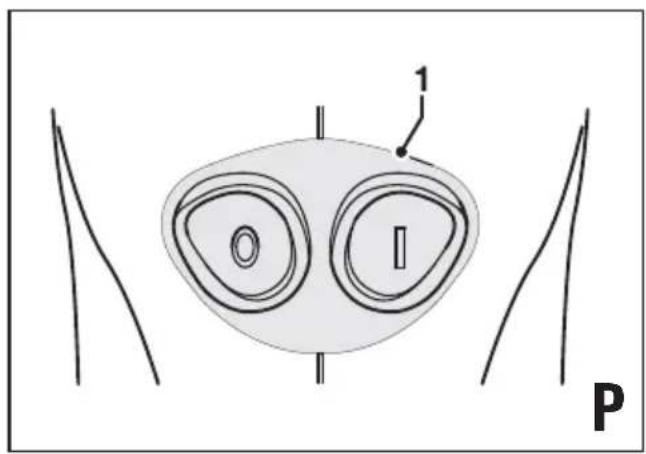 1 O I P