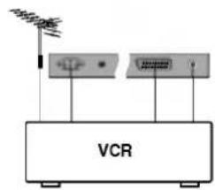 VCR