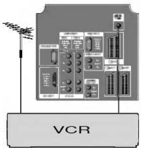VCR
