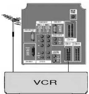 VCR