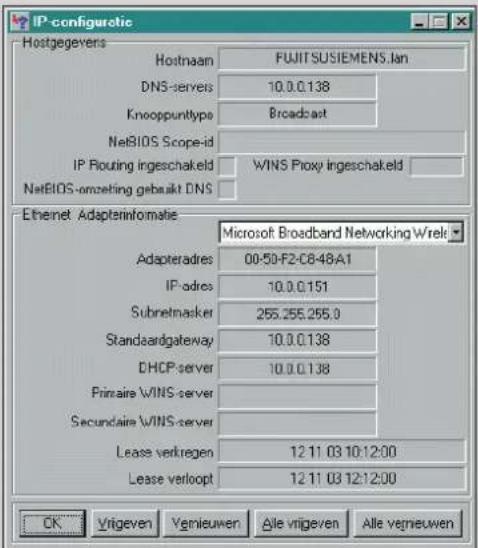 PHILIPS SL300i - Sådan kontrolleres computerens IP-konfiguration: - 1
