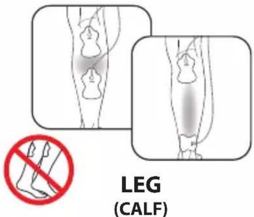 LEG (CALF)