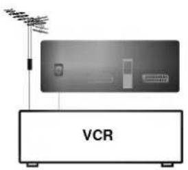 VCR