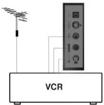 VCR