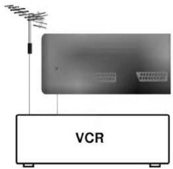 VCR