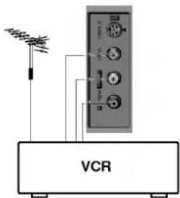VCR