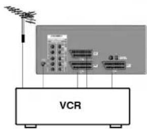 VCR