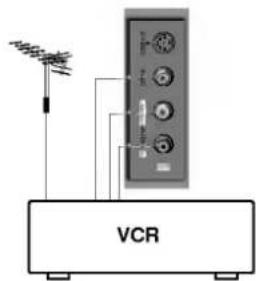 VCR