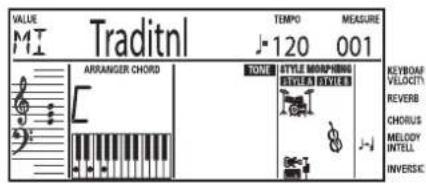 ROLAND EM-55 - Melodi intelligence - 2